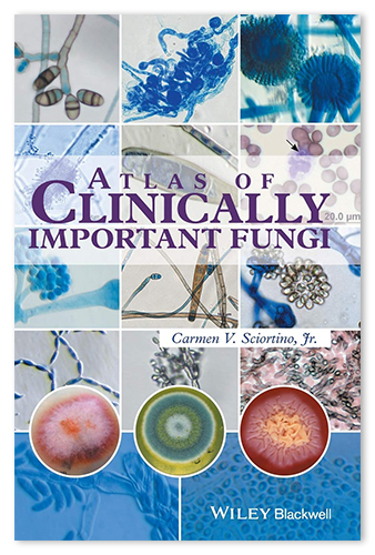 Atlas of Clinically Important Fungi, available for perpetual purchase to add to Credo Reference
