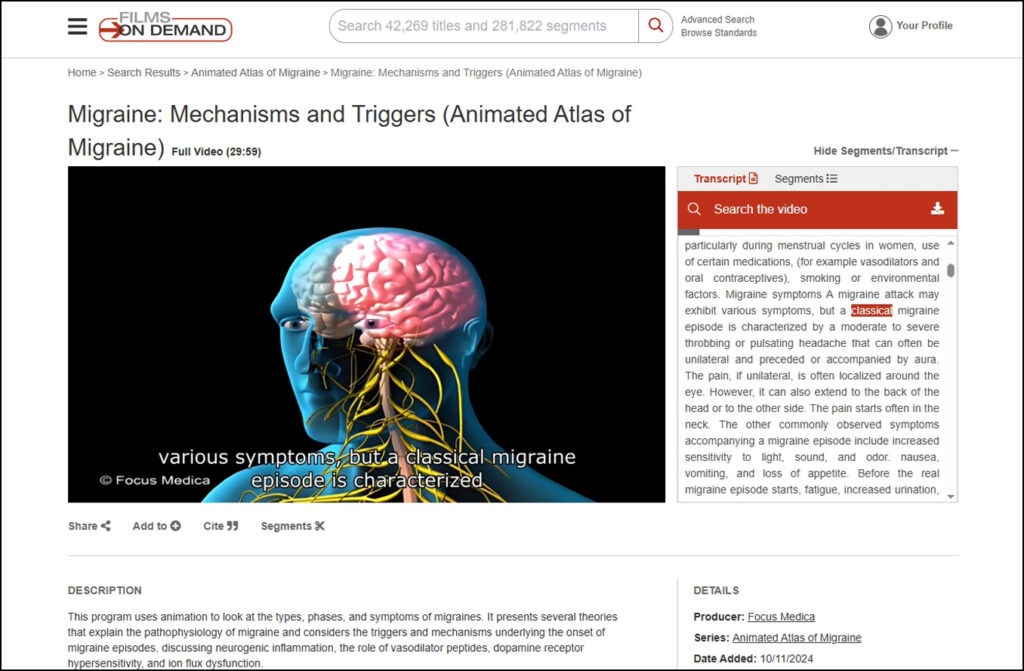 Animated Atlas of Migraine series from Focus Medica, available on Films On Demand Nursing Current Concepts and Practices Collection