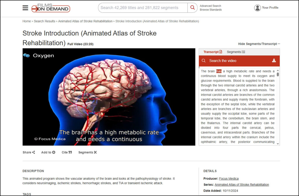 Animated Atlas of Stroke Rehabilitation series from Focus Medica, available on Films On Demand Nursing Current Concepts and Practices Collection