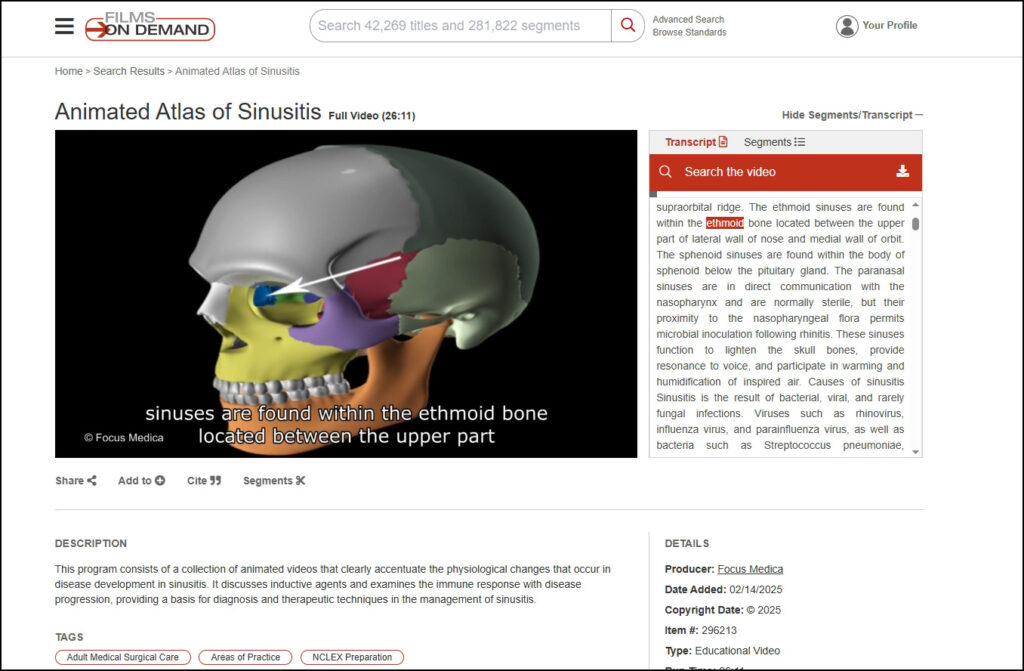 Animated Atlas of Sinusitis from Focus Medica, available on Films On Demand Nursing Current Concepts and Practices Collection